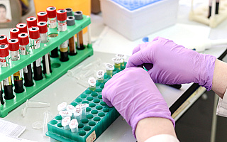 Ministerstwo Zdrowia: w Polsce będą produkowane testy genetyczne na koronawirusa